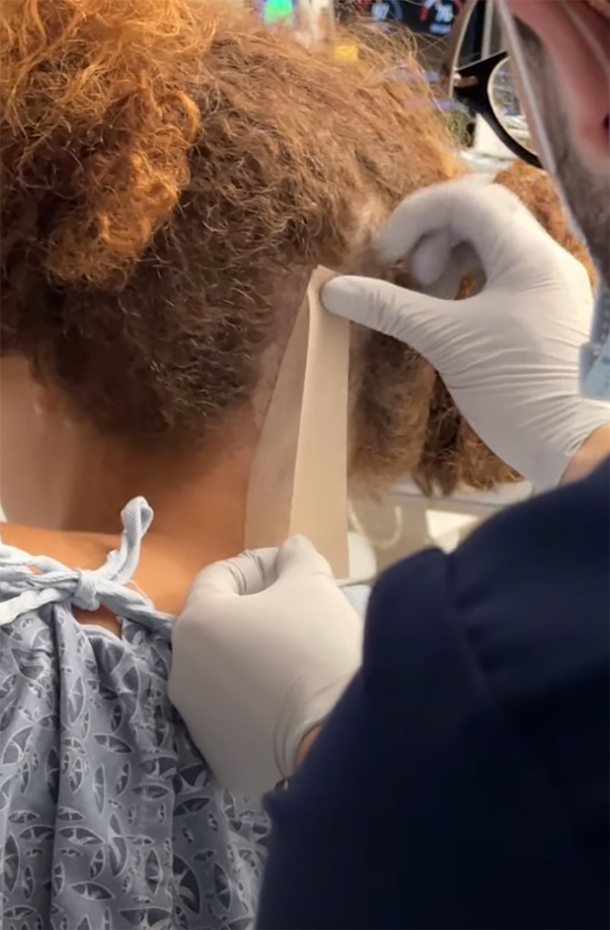 a doctor putting tape on the back of a woman's head