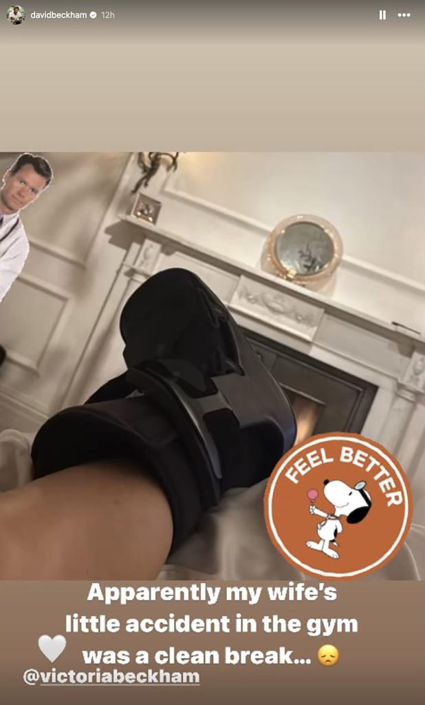 Victoria Beckham suffered a 'clean break' to her foot.