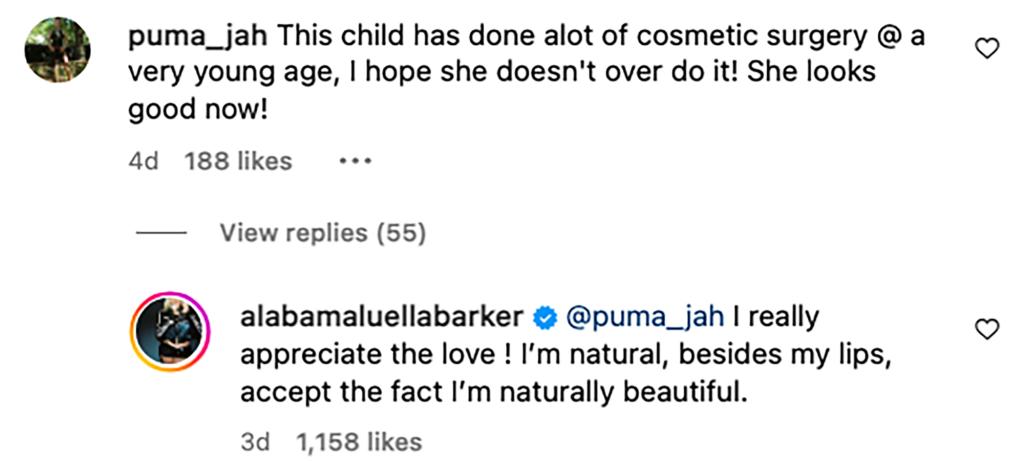 Alabama Barker responds to comments about her getting plastic surgery