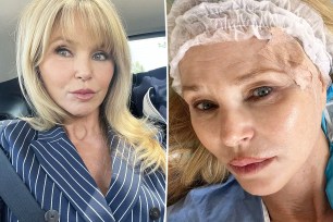 Christie Brinkley split image.