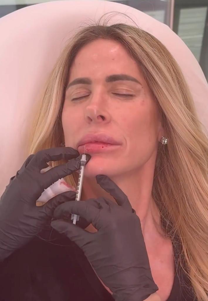 Kim Zolciak getting Botox and lip injections