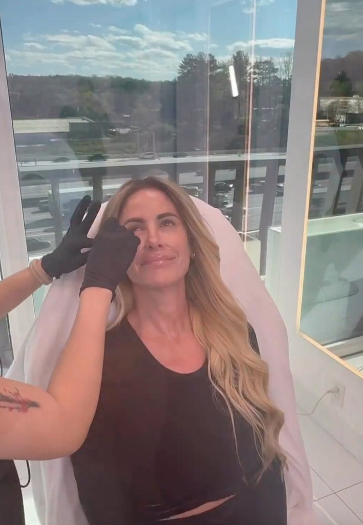 Kim Zolciak getting Botox and lip injections