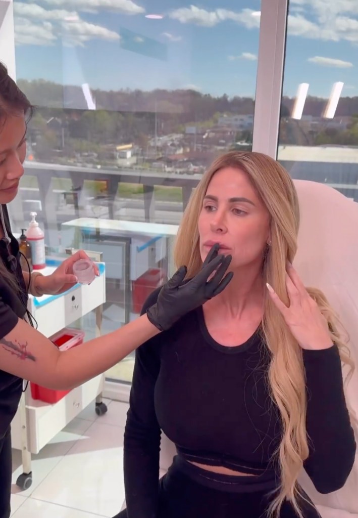 Kim Zolciak getting Botox and lip injections