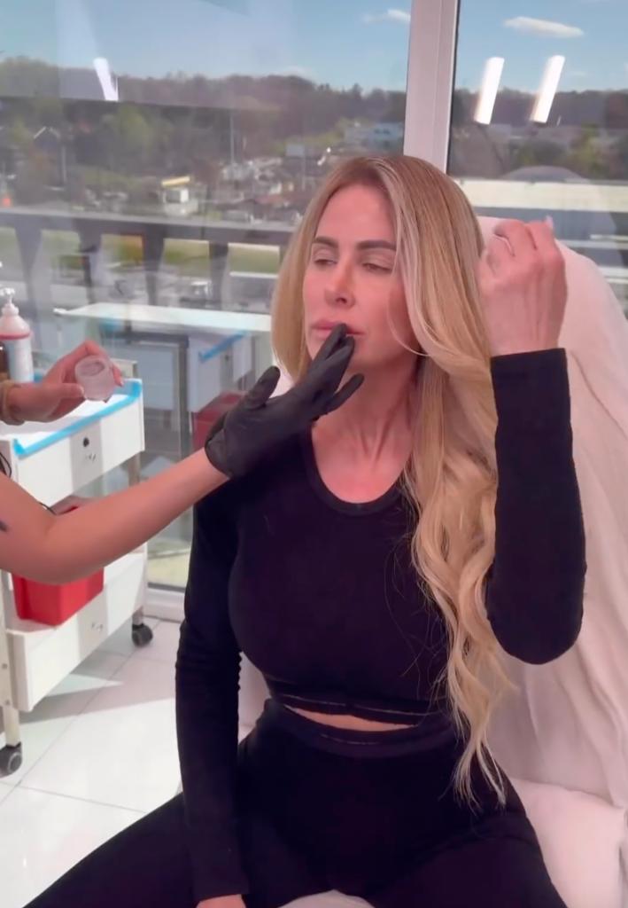 Kim Zolciak getting Botox and lip injections