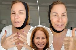 Jill Zarin reveals full ‘facial rejuvenation’ — here’s everything she had done