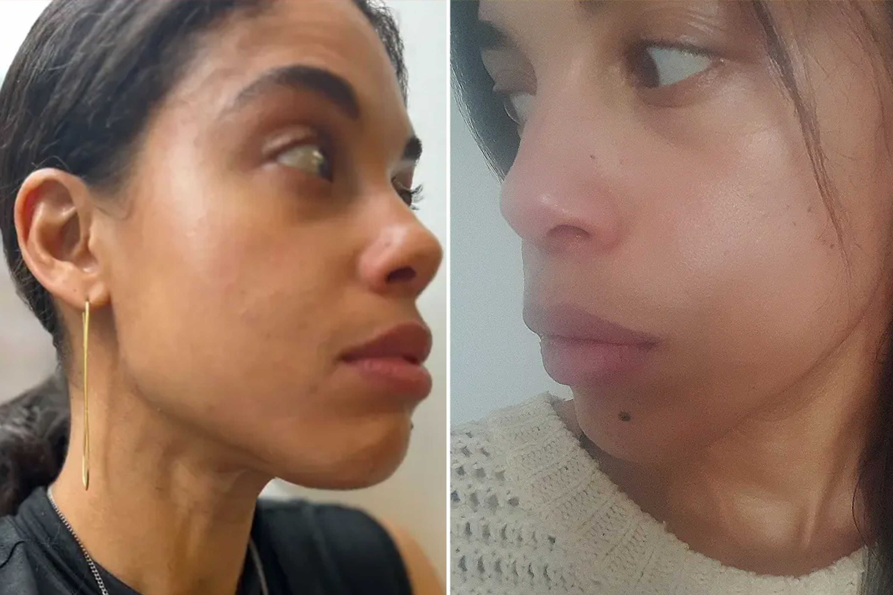 Before and after skincare photos