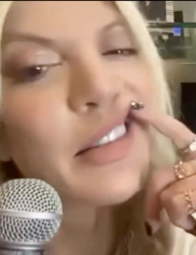 tori spelling lifting her lip to show her new teeth