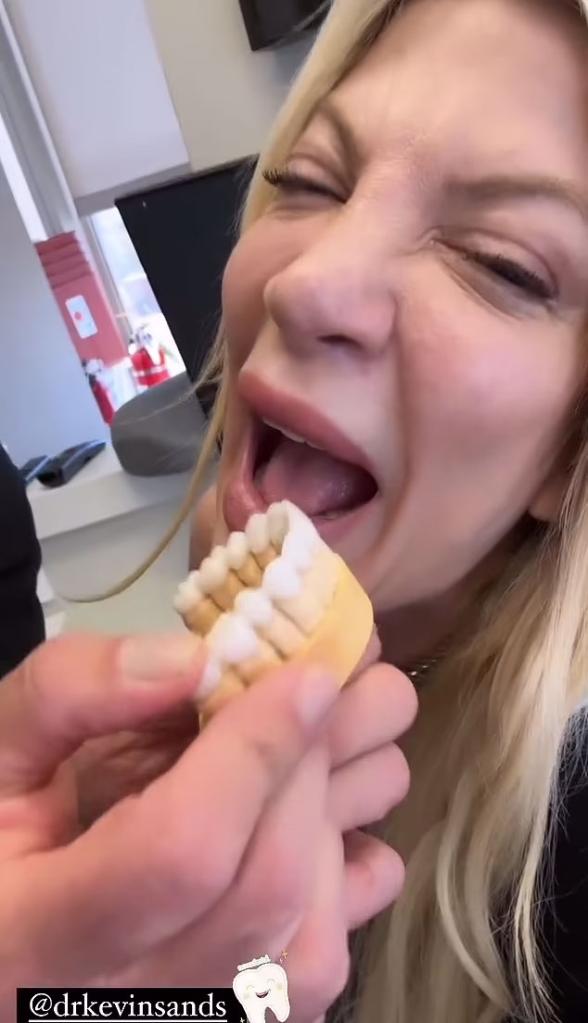 tori spelling with a mold of her mouth