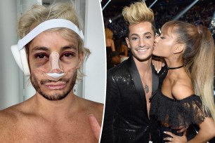 A split photo of a selfie of Frankie Grande with bruises and bandages over his face and Ariana Grande kissing Frankie Grande on the cheek