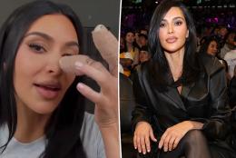 Kim Kardashian shows off gruesome finger injury that was 'more painful than childbirth'