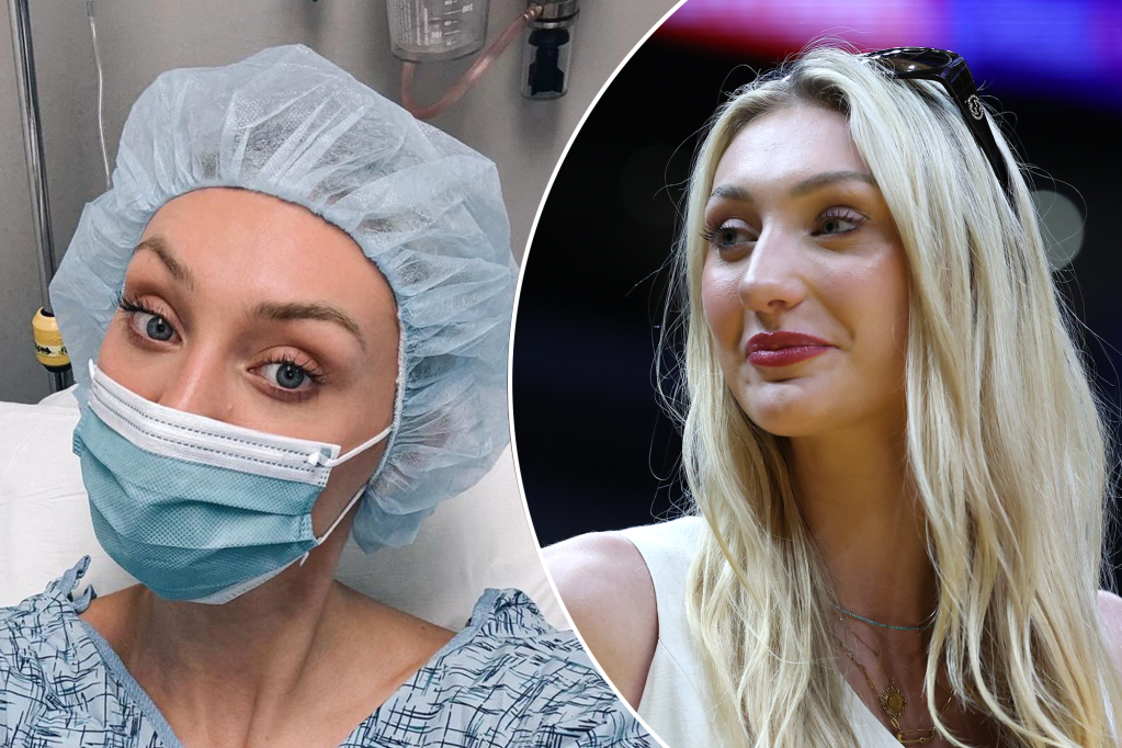 Cameron Brink reacts to fans who think she’s wearing full face of makeup after ACL surgery