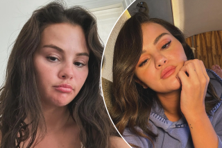 Selena Gomez reveals which cosmetic procedure she’s had done after fan speculation