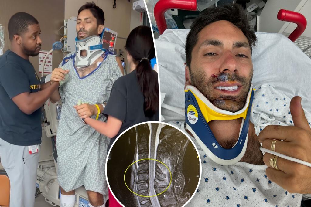 Nev Schulman reveals he broke his neck in bike accident: ‘I’m lucky to be here’