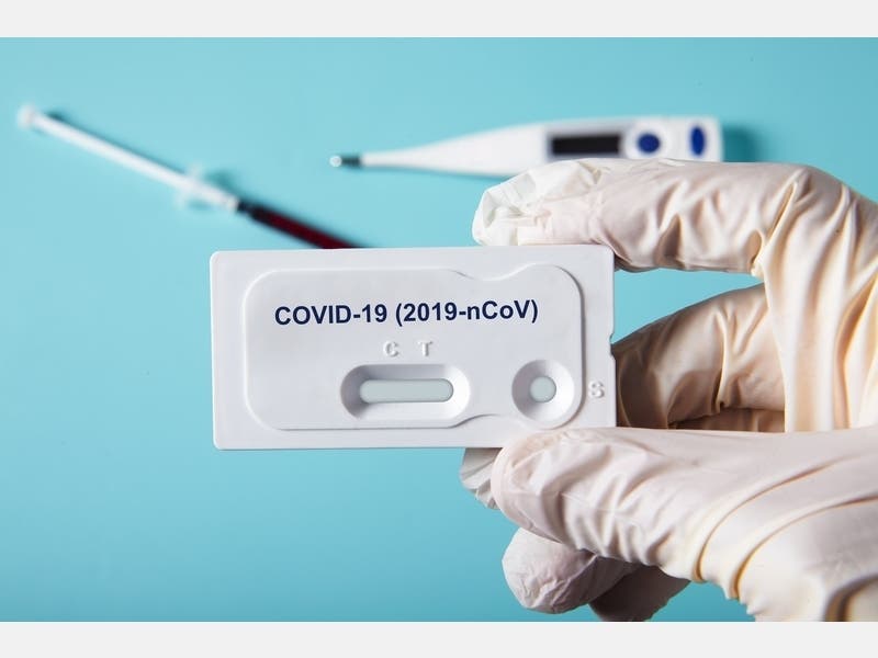 There are now 7,559 confirmed cases of coronavirus in Los Angeles County as of Wednesday.