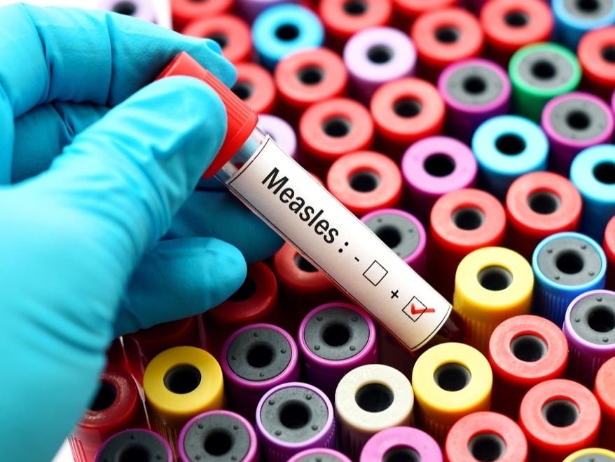 The number of measles cases reported as of Thursday in Virginia and 16 other states are equal to all cases reported in 2023, the CDC said.