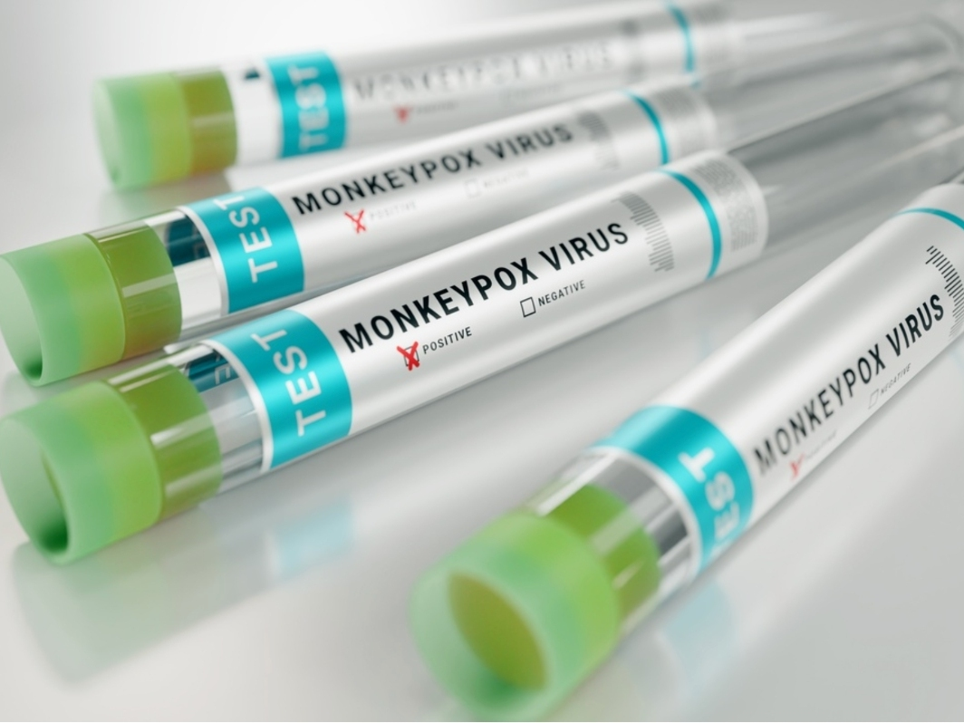 California Department of Public Health epidemiologist Dr. Erica Pan on Tuesday confirmed Bay Area wastewater surveillance systems are the nation’s first in which monkeypox has been detected, The San Francisco Chronicle reports.