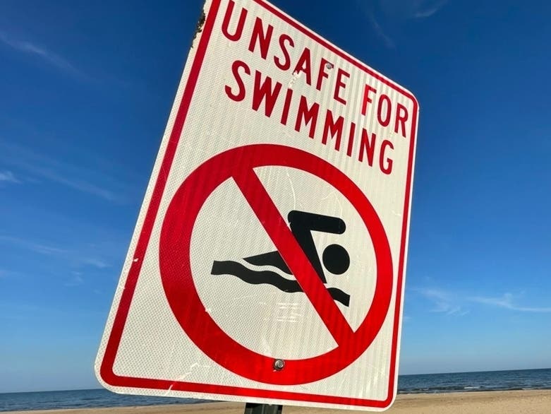 Swimming Again Barred At Part Of Manchester Lake