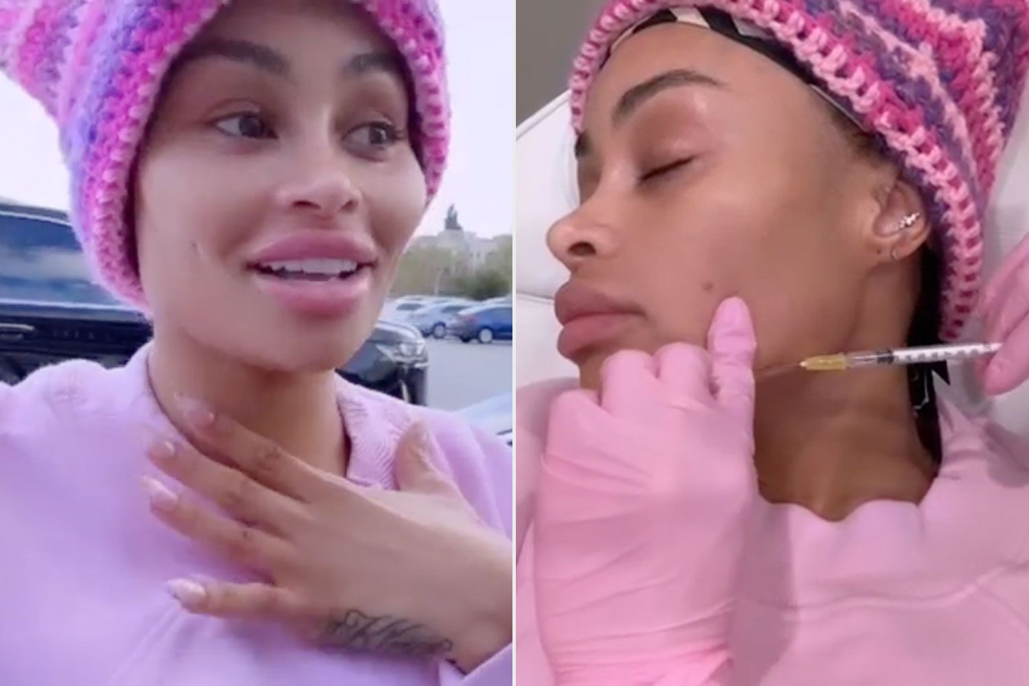 https://www.instagram.com/p/Cp1KEMLjgHX/. Blac Chyna Reveals Results of Having Her Facial Fillers Dissolved After 'Looking Like Jigsaw'. Blac Chyna/Instagram