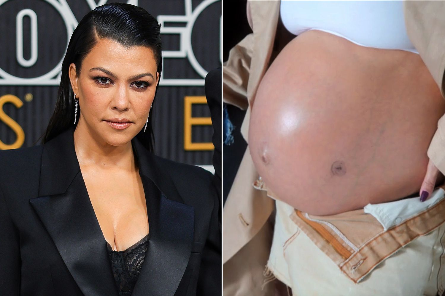 Kourtney Kardashian at the 75th Primetime Emmy Awards at Peacock Theater on January 15, 2024 in Los Angeles, California. kourtney kardashian fetal surgery scar