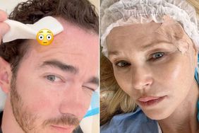 Celebs Who've Shared Skin Cancer Struggles kevin jonas christie brinkley