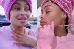 https://www.instagram.com/p/Cp1KEMLjgHX/. Blac Chyna Reveals Results of Having Her Facial Fillers Dissolved After 'Looking Like Jigsaw'. Blac Chyna/Instagram