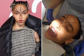 fka twigs braces