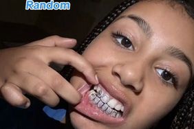 North West Shows Off Diamond Grill tiktok 01 17 24