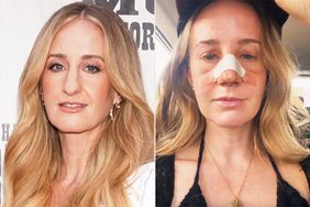 Country Singer Margo Price Opens Up About About Nose Job