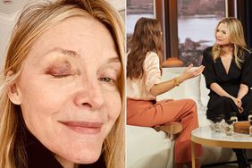 Michelle Pfeiffer Recalls How She Got a Black Eye While Playing Pickleball