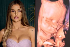 Lala kent baby scan instagram 06 27 24