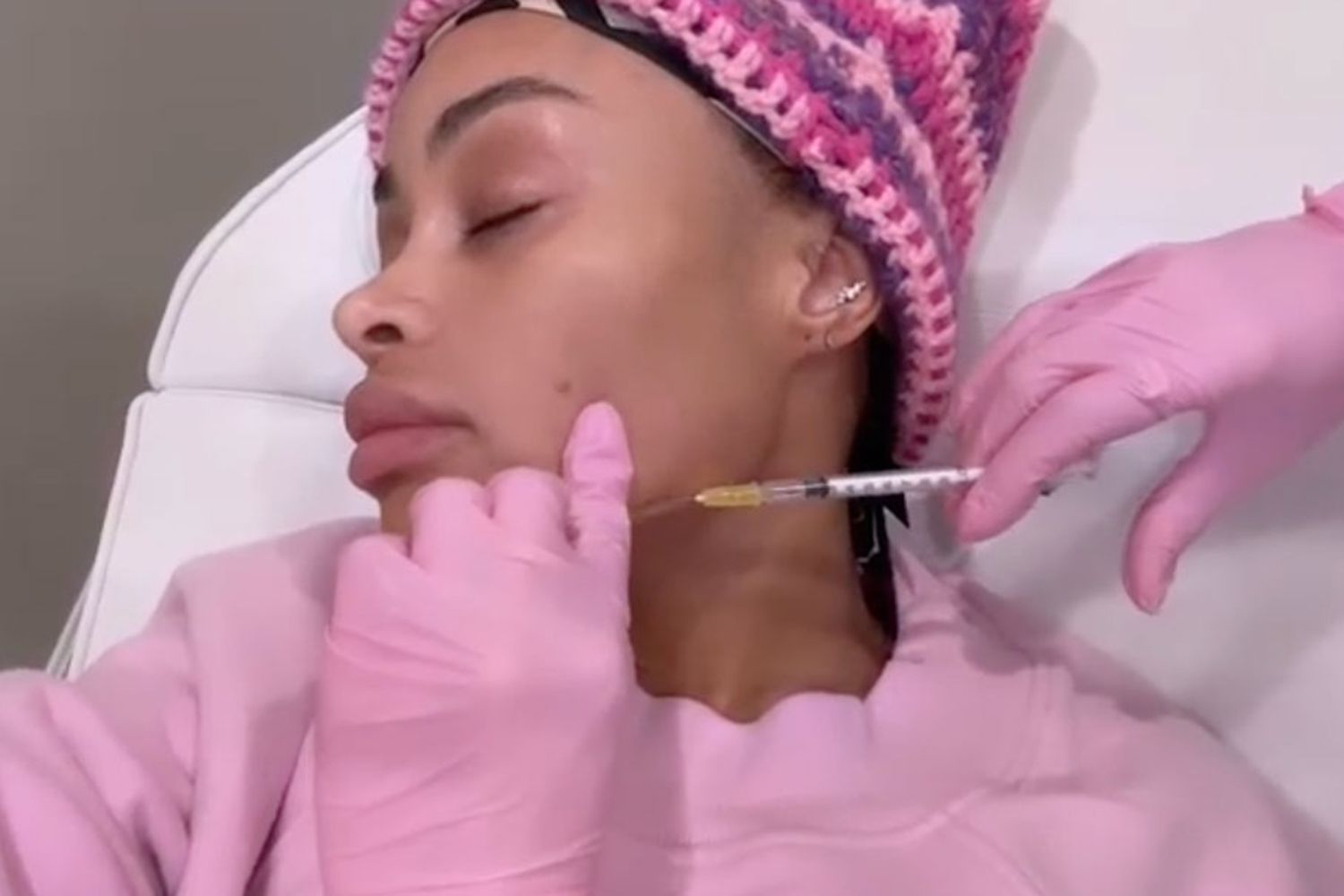 Blac Chyna facial fillers dissolved