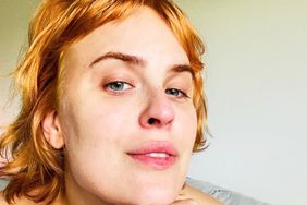 Tallulah Willis Has Fillers Dissolved, Says She Hasn't Seen Her 'Real Bone Structure' in 6 Years