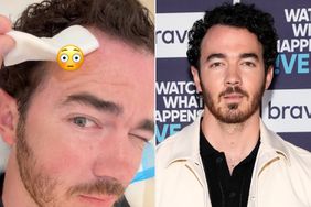 Kevin Jonas skin cancer