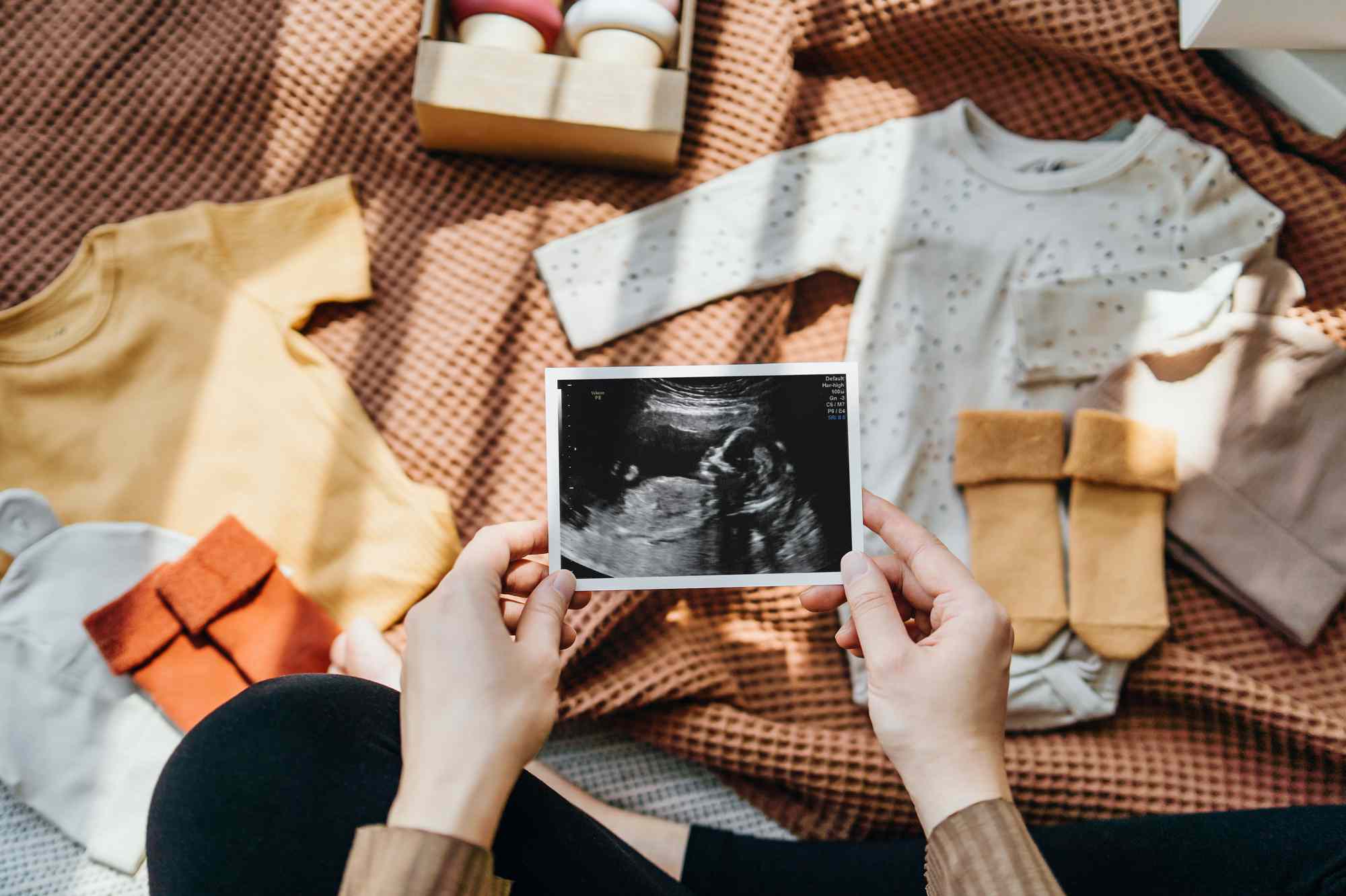 pregnant woman looking at a ultrasound scan photo