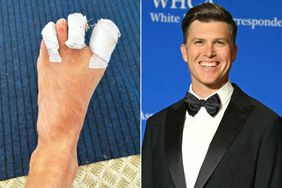 Colin Jost Gets a Nasty Toe Injury While Commentating Surfing for 2024 Paris Olympics