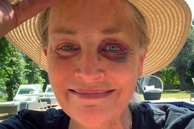 Sharon Stone Tells 'Worried' Fans How She Got Black Eye in Hotel Room: 'No, Nobody Did Anything to Me'