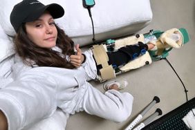 Nina Dobrev Recovering from Bike Accident