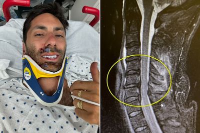 Nev Schulman Reveals He Broke His Neck in Accident Involving His Bike and a Truck