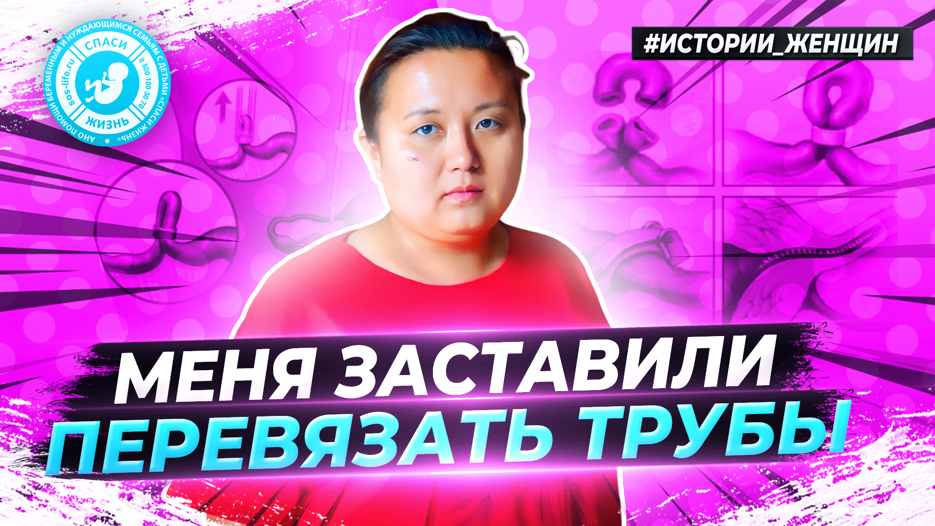 ● МЕНЯ ЗАСТАВИЛИ ПЕРЕВЯЗАТЬ ТРУБЫ! #ИСТОРИИ_ЖЕНЩИН