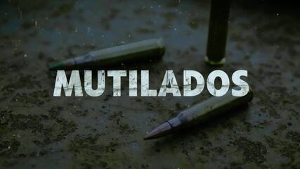 Mutilados: o drama de quem convive com as marcas da violência armada