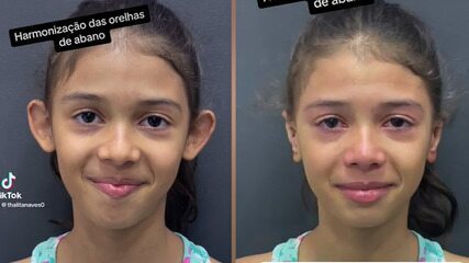 Menina se emociona ao ver resultado do procedimento para correção das suas orelhas