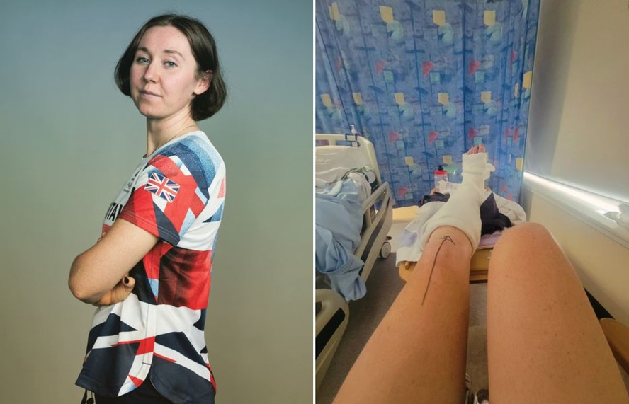 Katie Archibald sofreu deslocamento do tornozelo, fratura da tíbia, fratura da fíbula e rompimento de dois ligamentos após tropeçar em degrau no jardim