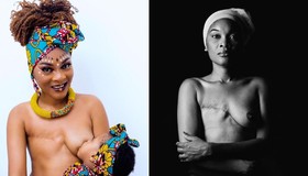 Angolana vence câncer e emociona ao amamentar após mastectomia