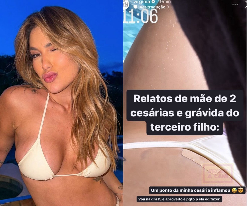 Virgínia Fonseca revelou que um de seus pontos da cesárea inflamou — Foto: Reprodução/Instagram