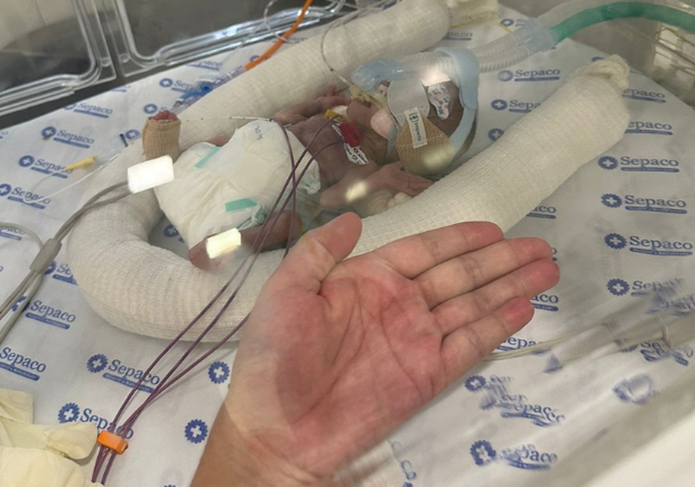 Nos primeiros dias de vida, Ester cabia na palma da mão — Foto: Arquivo pessoal