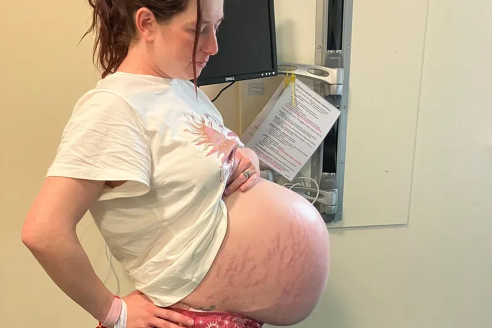Arlene deu à luz com 30 semanas — Foto: Reprodução BBC/NHS Lothian