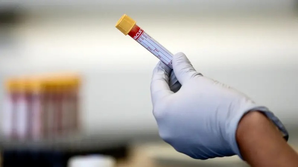 Em uma amostra do sangue, os biomarcadores podem representar uma fotografia do estado bioquímico atual do seu corpo — Foto: PA via BBC