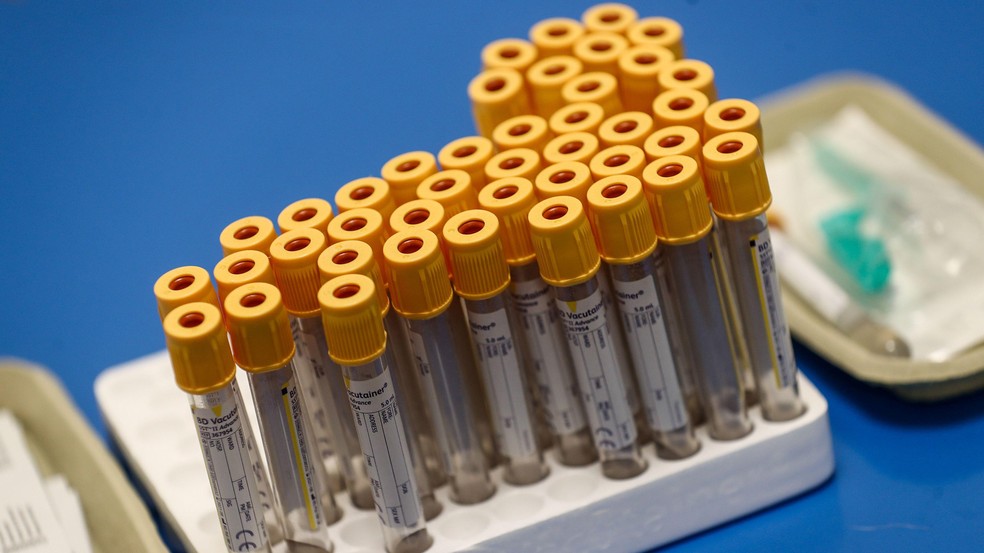 BBC News fonte — Foto: Os exames de sangue poderiam ajudar a diminuir a causa da fadiga