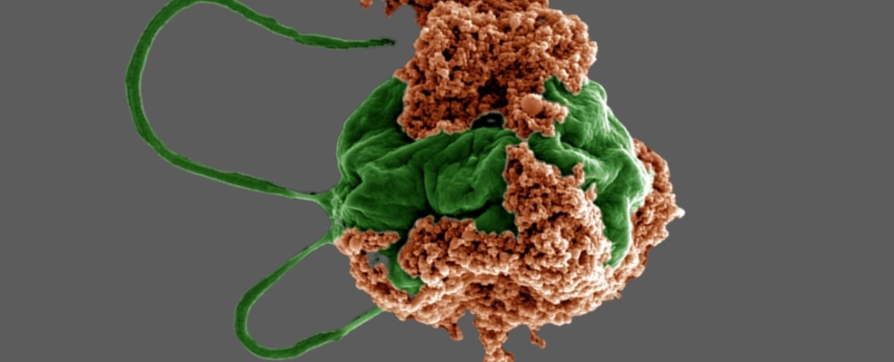 Parte alga, parte célula vermelha do sangue, esses microrrobôs podem viajar para tumores de difícil acesso — Foto: Reprodução/Zhang et al., Sci. Adv., 2024/CC BY-NC