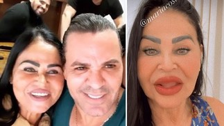 Mãe do sertanejo Eduardo Costa exibe novo visual após harmonização  — Foto: Instagram